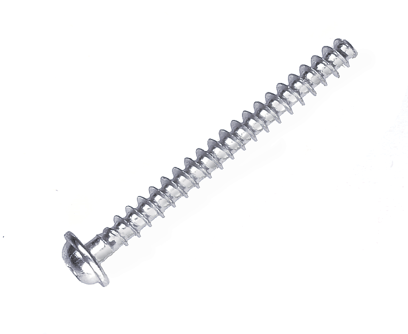 SCREW